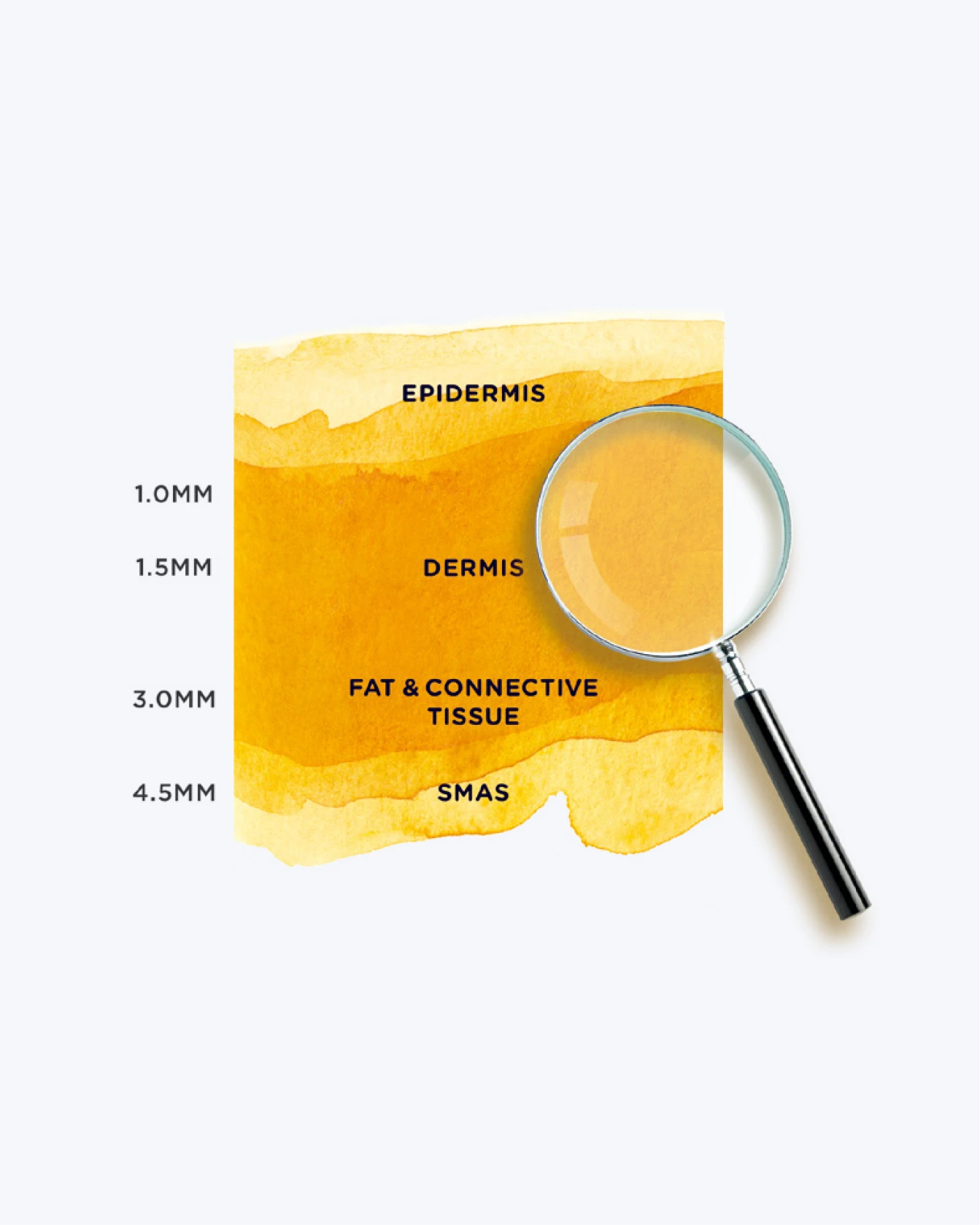써마지 FLX 팁